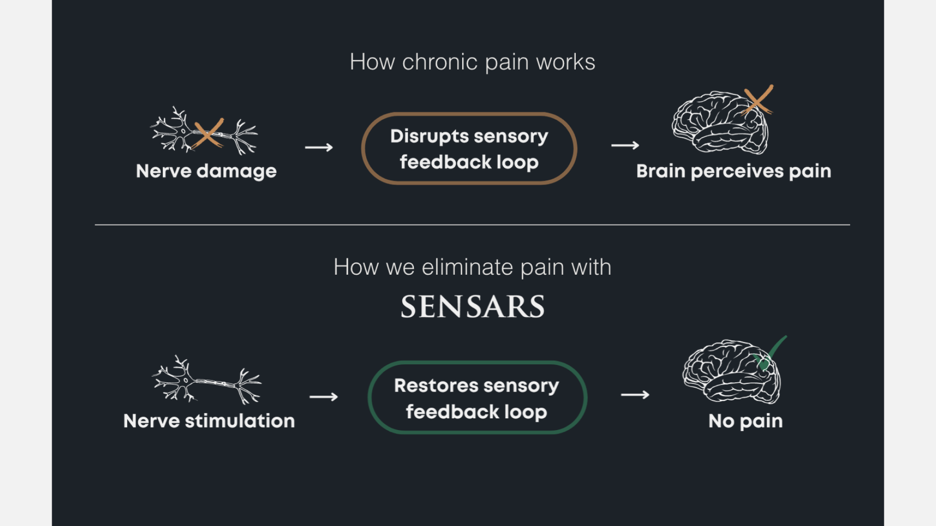 Sensars Pain Treatment